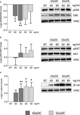 Osteocalcin modulates parathyroid cell function in human parathyroid tumors